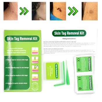 Micro Band Mole Removal Sticker Patch Sweep Spot Freckle Wart Tool For Small To Medium Skin Tag Remover Kit Face Skin Care Salon
Micro Band Mole Removal Sticker Patch Sweep Spot Freckle Wart Tool For Small To Medium Skin Tag Remover Kit Face Skin Care Salon