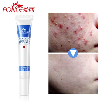 Fonce treatment acne Cream for acne scars mark remover skin lightening Anti Acne face cream whitening to remove dark spots 20g
Fonce treatment acne Cream for acne scars mark remover skin lightening Anti Acne face cream whitening to remove dark spots 20g