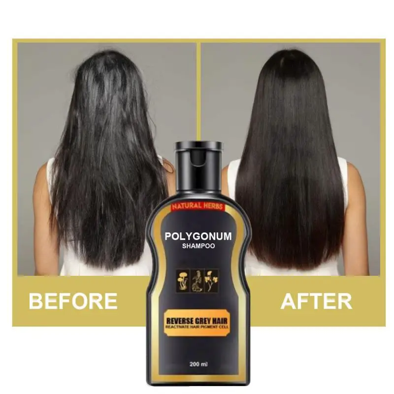 Polygonum Multiflorum Black Hair Shampoo Natural Shampoos Hair Care Repair Oil Control Anti-dandruff Cream Shampoo 30ml
Polygonum Multiflorum Black Hair Shampoo Natural Shampoos Hair Care Repair Oil Control Anti-dandruff Cream Shampoo 30ml