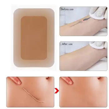 Tattoo Flaw Conceal Tape Waterproof Scar Acne Birthmark Concealer Cover Stickers Perfectly Hide Your Tattoos and Scars
Tattoo Flaw Conceal Tape Waterproof Scar Acne Birthmark Concealer Cover Stickers Perfectly Hide Your Tattoos and Scars