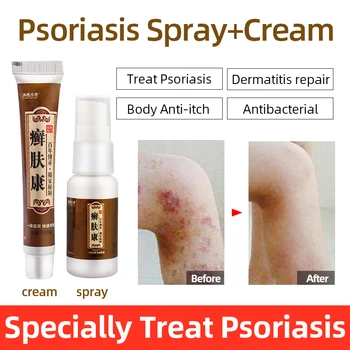 Natural Herbal Psoriasis Cream Medicine Antibacterial Eczema Psoriasis Dermatitis Itching Ointment Work For Skin Problems Patch
Natural Herbal Psoriasis Cream Medicine Antibacterial Eczema Psoriasis Dermatitis Itching Ointment Work For Skin Problems Patch