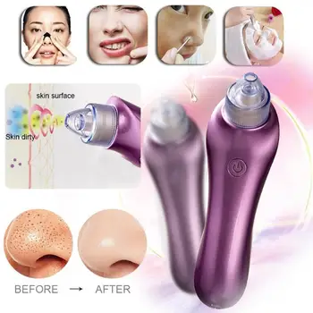 Electric Vacuum Blackhead Remover Pore Facial Acne Pimple Removal Suction Tool Face Clean Machine Facial Skin Care Pore Cleaner
Electric Vacuum Blackhead Remover Pore Facial Acne Pimple Removal Suction Tool Face Clean Machine Facial Skin Care Pore Cleaner