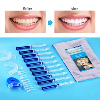 BellyLady 10pcs Teeth Whitening Gel Kit Bleaching Bright White Smiles Teeth Gel with LED Light Tooth Socket 
BellyLady 10pcs Teeth Whitening Gel Kit Bleaching Bright White Smiles Teeth Gel with LED Light Tooth Socket