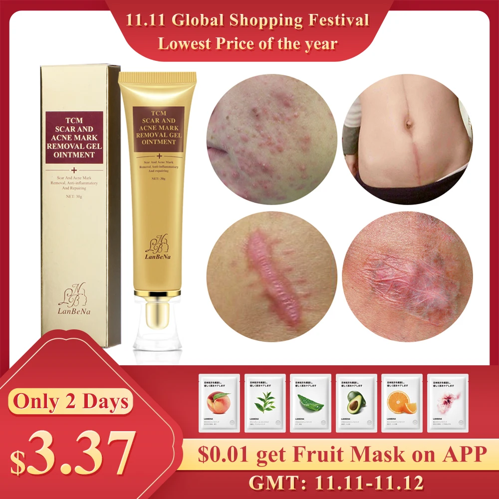 LANBENA Acne Scar Removal Cream Skin Repair Face Cream Acne Spots Acne Treatment Blackhead Whitening Cream Stretch Marks 30ml
LANBENA Acne Scar Removal Cream Skin Repair Face Cream Acne Spots Acne Treatment Blackhead Whitening Cream Stretch Marks 30ml