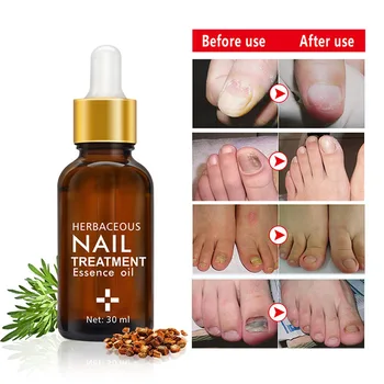 30ml Nail Care Serum To Remove Nail Fungus Damage Softening Nail Treatment Liquid Nail Nutrition Essence
30ml Nail Care Serum To Remove Nail Fungus Damage Softening Nail Treatment Liquid Nail Nutrition Essence