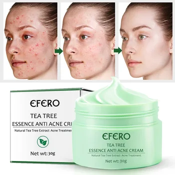 Efero Tea Tree Essence Anti-Acne Cream Acne Acne Removing Acne Marks Pit Acne Repair Cream Cross-Border Exclusive
Efero Tea Tree Essence Anti-Acne Cream Acne Acne Removing Acne Marks Pit Acne Repair Cream Cross-Border Exclusive
