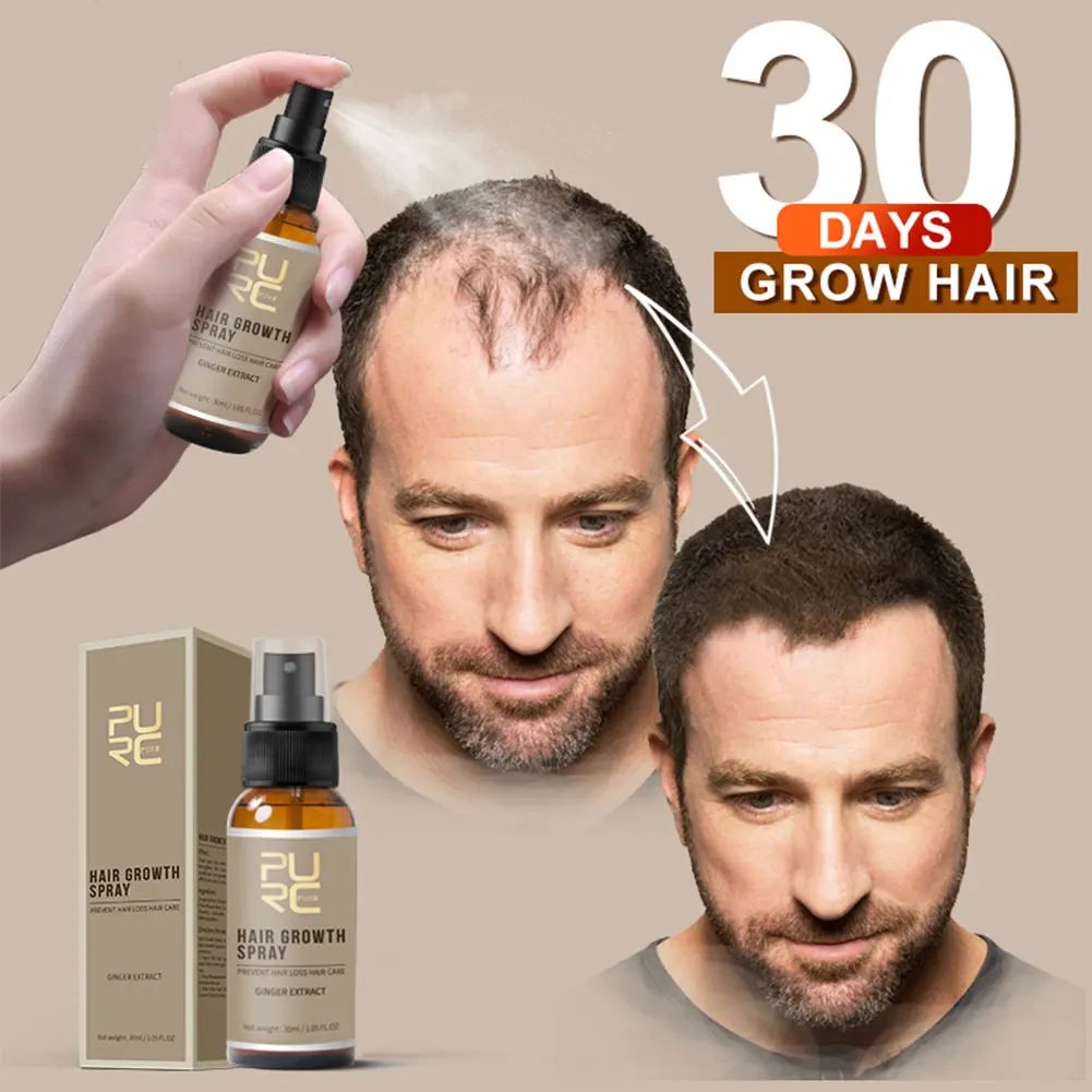 New 30ml Hair Growth Spray Ginger Essence Spray Effective Extract Anti Hair Loss Nourish Roots Preventing Hair Loss
New 30ml Hair Growth Spray Ginger Essence Spray Effective Extract Anti Hair Loss Nourish Roots Preventing Hair Loss