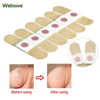 20Pcs Medical Plaster Foot Corn Removal Warts Thorn Patches Foot Corn Calluses Callosity Detox Clavus Medical Plaster D0722 
20Pcs Medical Plaster Foot Corn Removal Warts Thorn Patches Foot Corn Calluses Callosity Detox Clavus Medical Plaster D0722