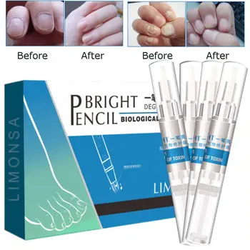 4PCS 3ml Finger Foot Nail Bright Pencil Anti Fongique Infection Fungal Treatment Biological Repair Nail Treatments Restores
4PCS 3ml Finger Foot Nail Bright Pencil Anti Fongique Infection Fungal Treatment Biological Repair Nail Treatments Restores