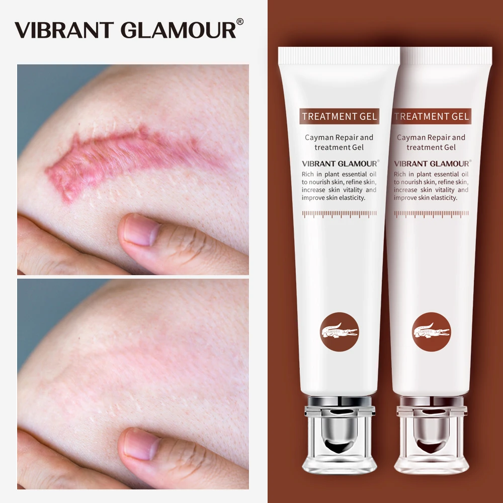 

VIBRANT GLAMOUR Repair Scar cream Removal Acne Scars Gel Stretch Marks Surgical Scar Burn Body Pigmentation Corrector Care 2pcs