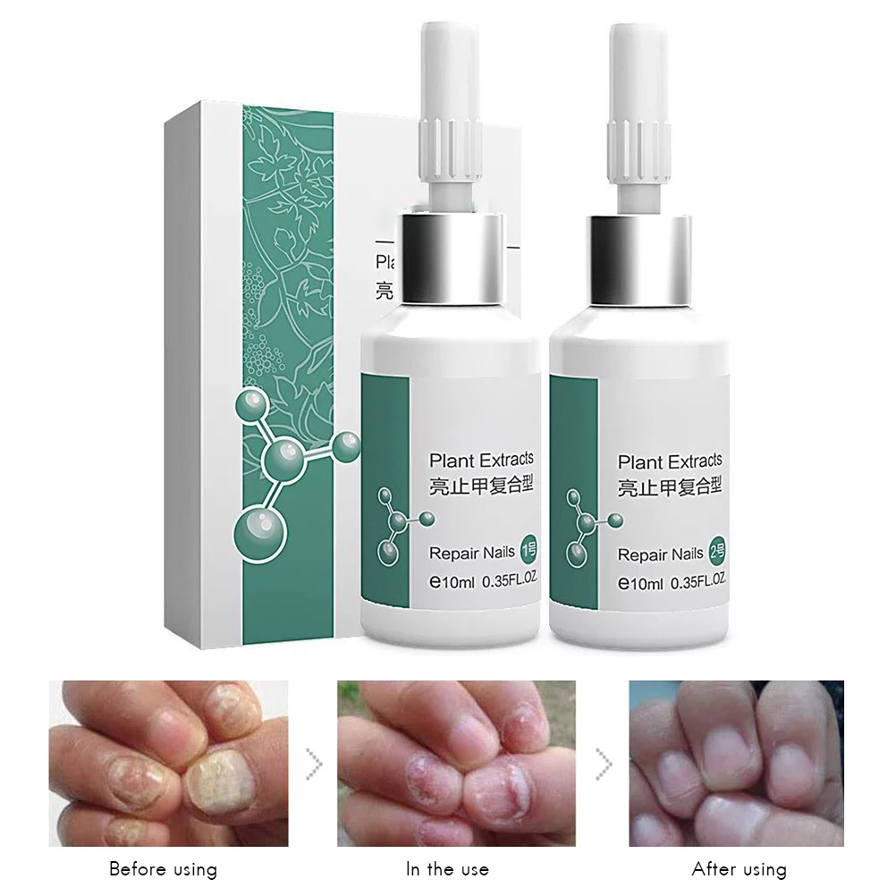 Nail Treatment Liquid Antifungal Nail Repair Toe Finger Fungus Antibacterial Nail Treatment Liquid Repairing Damaged Nail Bed
Nail Treatment Liquid Antifungal Nail Repair Toe Finger Fungus Antibacterial Nail Treatment Liquid Repairing Damaged Nail Bed