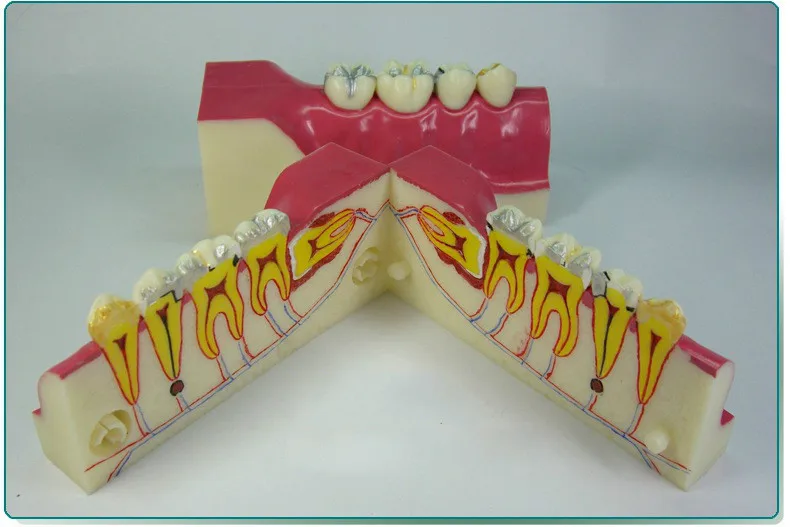 2 шт. анатомическая модель зубов с внутренним кронштейном | Канцтовары для офиса и