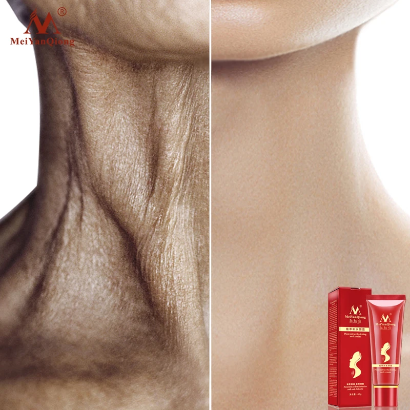Hot Butter Extract Hydrating Neck Cream Moisturizing Soft And Delicate Fade Reduce Double Neck Care
Hot Butter Extract Hydrating Neck Cream Moisturizing Soft And Delicate Fade Reduce Double Neck Care