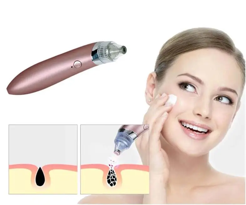 Blackhead Remover Face Deep Pore Cleaner Acne Pimple Removal Vacuum Suction Diamond Dermabrasion Facial Care Tool+ Makeup Brush
Blackhead Remover Face Deep Pore Cleaner Acne Pimple Removal Vacuum Suction Diamond Dermabrasion Facial Care Tool+ Makeup Brush