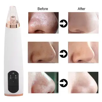 Portable Household Electric Blackhead Removal Suction Instrument Face Pore Cleaner Acne Cleansing Beauty Device for Travel 
Portable Household Electric Blackhead Removal Suction Instrument Face Pore Cleaner Acne Cleansing Beauty Device for Travel