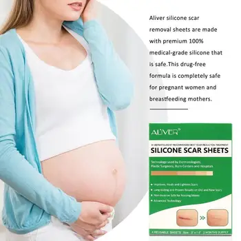 Scar Stickers Silicone Scar Removal Patch Reusable Acne Gel Scar Therapy Silicon Patch Remove Trauma Skin Repair Health Patch
Scar Stickers Silicone Scar Removal Patch Reusable Acne Gel Scar Therapy Silicon Patch Remove Trauma Skin Repair Health Patch