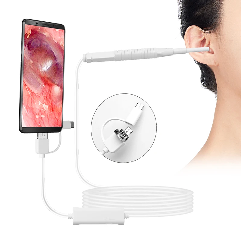 AN103 white 3.9MM lens otoscope inspection camera ear cleaner otoscope medical micro usb ear pick ear picker with gift box
AN103 white 3.9MM lens otoscope inspection camera ear cleaner otoscope medical micro usb ear pick ear picker with gift box