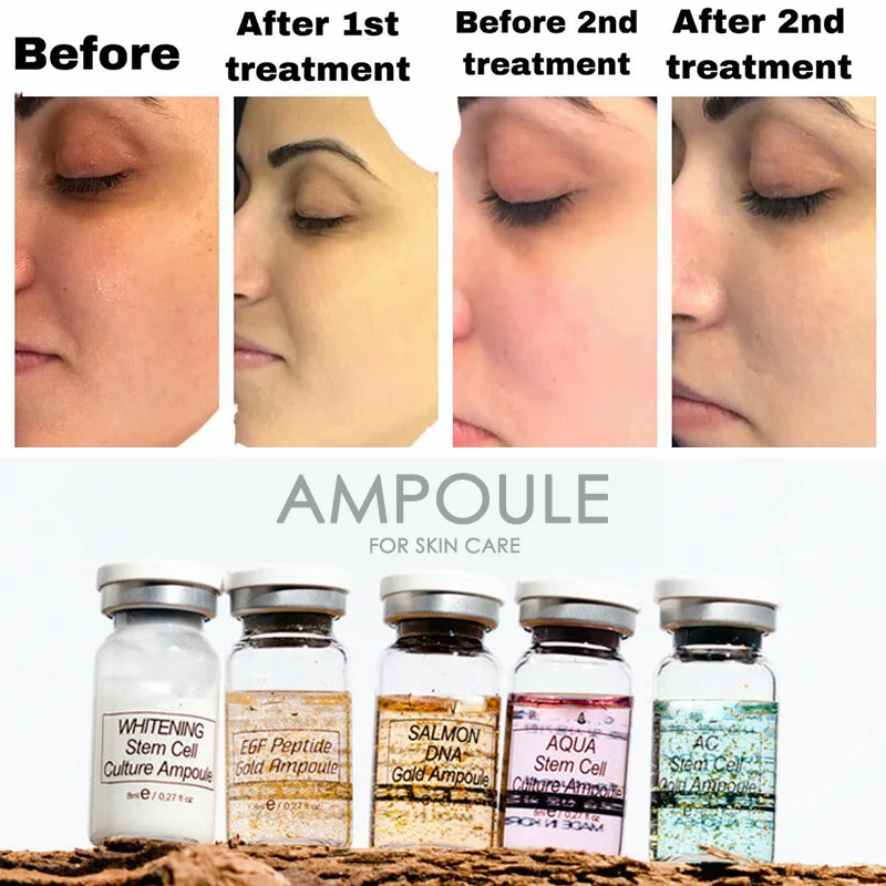 Whitening Stem Cell Culture Ampoule Hyaluronic Acid Nicotinamide Dark Spot Corrective Essence Anti-Aging Booster Face Serum
Whitening Stem Cell Culture Ampoule Hyaluronic Acid Nicotinamide Dark Spot Corrective Essence Anti-Aging Booster Face Serum