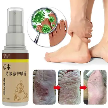 Antifungal Foot Spray Anti Bacterial Deodorant Powder Feet Liquid Odor Care Sweat Herbal Care Spray Anti Foot Foot Athlete E9S7
Antifungal Foot Spray Anti Bacterial Deodorant Powder Feet Liquid Odor Care Sweat Herbal Care Spray Anti Foot Foot Athlete E9S7