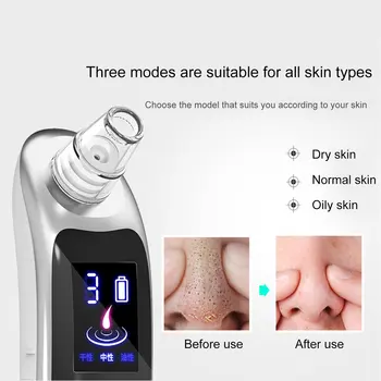 Charging Blackhead Instrument Charging Home Beauty Cleansing Remove Blackhead Pores Clean Electric Blackhead Cleaner
Charging Blackhead Instrument Charging Home Beauty Cleansing Remove Blackhead Pores Clean Electric Blackhead Cleaner