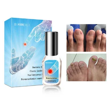 Nail Repair Liquid Disinfection Bacteriostatic Nail Repair Solution Onychomycosis & Paronychia Nail Treatment Nail Care
Nail Repair Liquid Disinfection Bacteriostatic Nail Repair Solution Onychomycosis & Paronychia Nail Treatment Nail Care