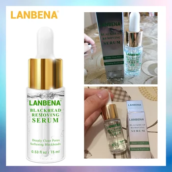 Lanbena 15ml Softener Blackhead Derived Liquid Nose Black Head Remover Acne Treatment Deep Cleansing Skin Care !
Lanbena 15ml Softener Blackhead Derived Liquid Nose Black Head Remover Acne Treatment Deep Cleansing Skin Care !