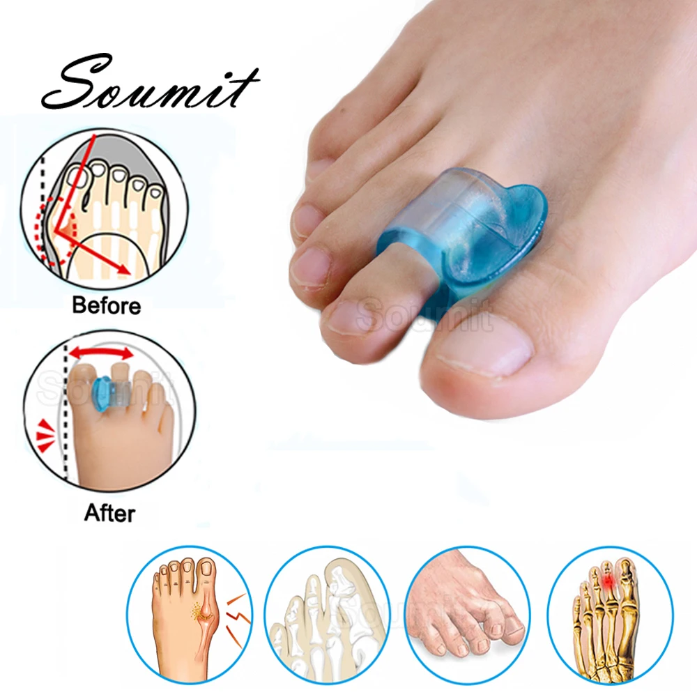 Soft Silicone Gel Toe Separator for Hallux Valgus Bunion Spacers Thumb Corrector Orthopedic Straightener Adjuster Foot Care Tool
Soft Silicone Gel Toe Separator for Hallux Valgus Bunion Spacers Thumb Corrector Orthopedic Straightener Adjuster Foot Care Tool