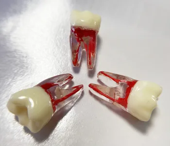 Student Model 36# 1st Molar Lower 3-Rooted Endo File Blocks Canal Pulp Files Teeth Dental School Practise Dentist Study
Student Model 36# 1st Molar Lower 3-Rooted Endo File Blocks Canal Pulp Files Teeth Dental School Practise Dentist Study