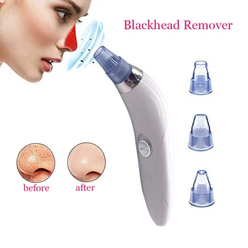 Blackhead Remover Facial Pore Vacuum Extractor Acne Pimple Nose Cleansing Suction Exfoliating Pore Face Cleaner Makeup Tools 
Blackhead Remover Facial Pore Vacuum Extractor Acne Pimple Nose Cleansing Suction Exfoliating Pore Face Cleaner Makeup Tools