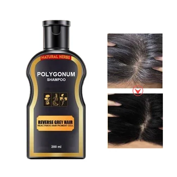 200ml Polygonum Multiflorum Shampoo Anti-Dandruff Shampoo Moisturizing Refreshing Oil Control Shampoo Hair Care
200ml Polygonum Multiflorum Shampoo Anti-Dandruff Shampoo Moisturizing Refreshing Oil Control Shampoo Hair Care