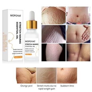 Stretch Mark Remover Essential Oil Skin Care Treatment Nourishing Whitening Pregnancy Repair Oil
Stretch Mark Remover Essential Oil Skin Care Treatment Nourishing Whitening Pregnancy Repair Oil