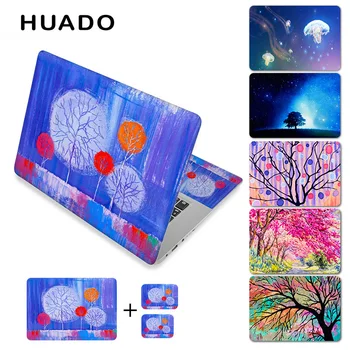 Special Tree Laptop Skin Sticker Decal 13.3" 15" 15.6" 17" Notebook Surface Cover for Dell/Lenovo/Asus/Macbook
Special Tree Laptop Skin Sticker Decal 13.3" 15" 15.6" 17" Notebook Surface Cover for Dell/Lenovo/Asus/Macbook
