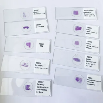 200pcs/set Professional Medical Students Use Human Pathology Prepared Slides
200pcs/set Professional Medical Students Use Human Pathology Prepared Slides