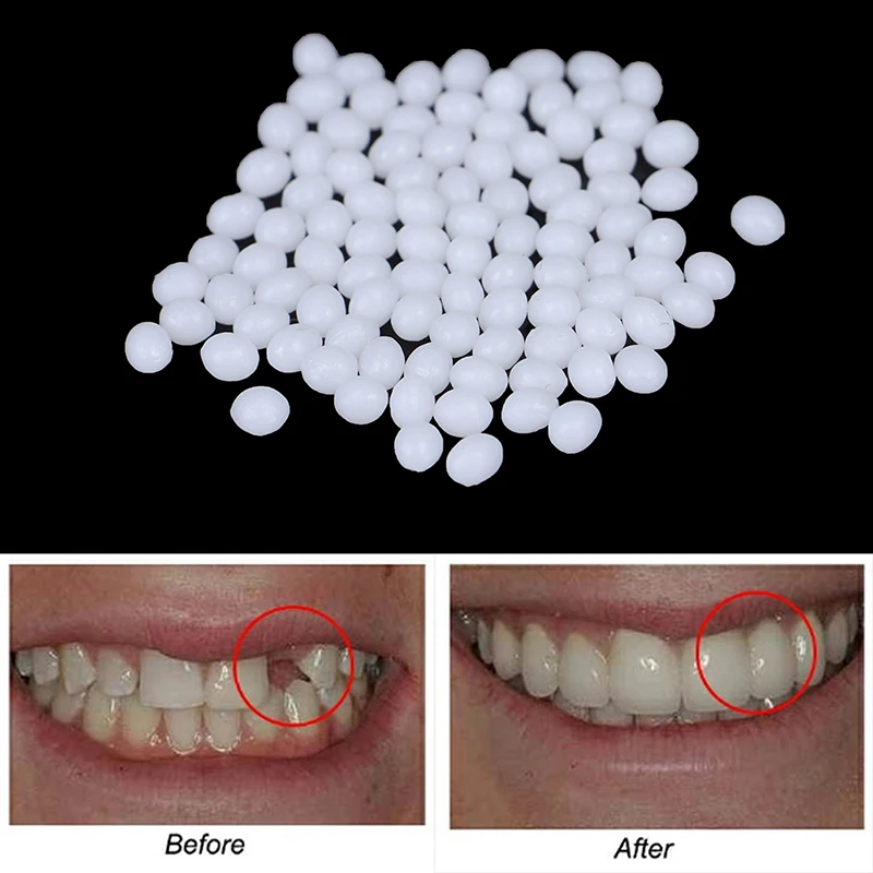 Фото 5g-100 г набор для временного ремонта зубов клей зубных протезов инструмент