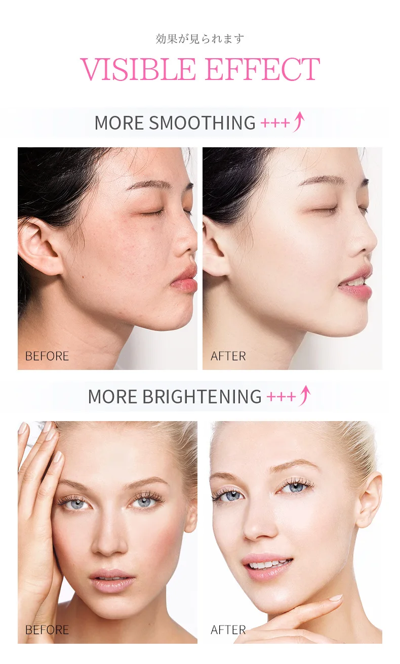 LAIKOU Snail Face Cream Hyaluronic acid Moisturizer Serum Set Nicotinamide Vitamin C Whitening Anti-wrinkle Anti-aging skin care LAIKOU Snail Face Cream Hyaluronic acid Moisturizer Serum Set Nicotinamide Vitamin C Whitening Anti-wrinkle Anti-aging skin care