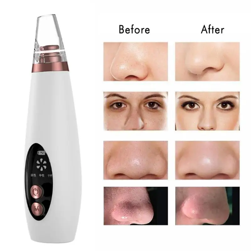 6 In 1 Electric Blackhead Remover Pore Cleanser Vacuum Acne Suction Face Deeply Cleaning Rechargeable Instrument With 6 Suckers
6 In 1 Electric Blackhead Remover Pore Cleanser Vacuum Acne Suction Face Deeply Cleaning Rechargeable Instrument With 6 Suckers