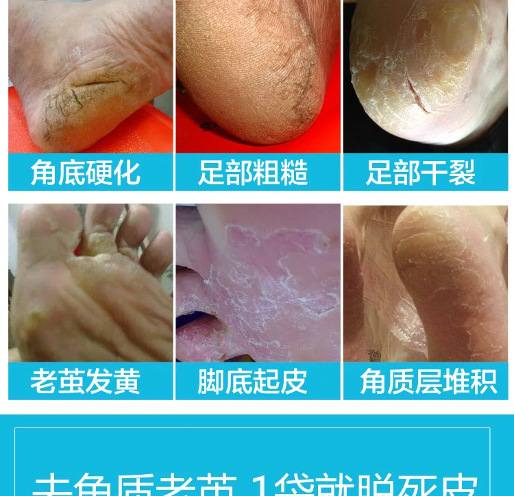 牛乳足膜-详情_03