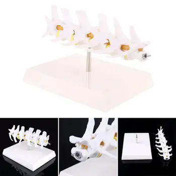 Dog Canine Lumbar Disc Herniation Model Aid Teaching Anatomy Instruments Study Research Display 
Dog Canine Lumbar Disc Herniation Model Aid Teaching Anatomy Instruments Study Research Display