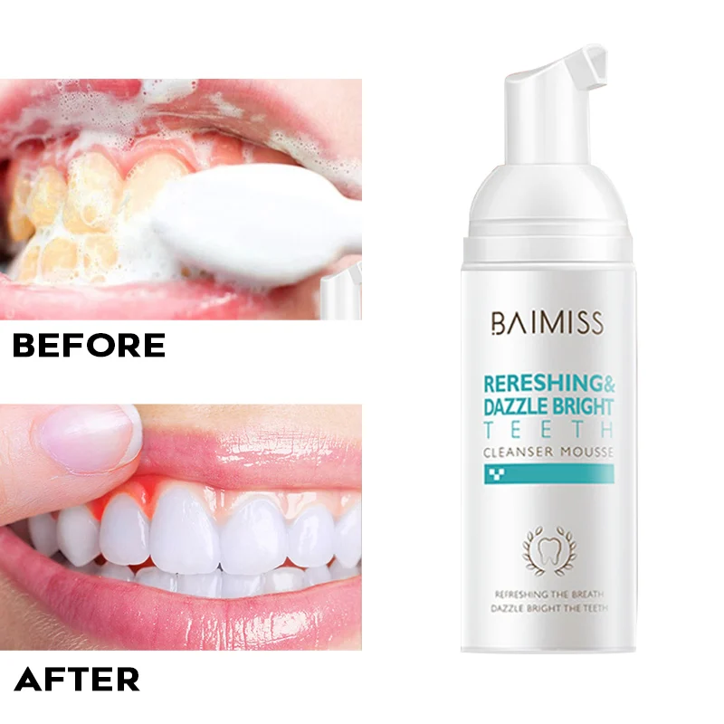 Shining Tooth-Cleaning Mousse Toothpaste Teeth Whitening Oral Hygiene Removes Plaque Stains Bad Breath Dental Tool Dropshipping
Shining Tooth-Cleaning Mousse Toothpaste Teeth Whitening Oral Hygiene Removes Plaque Stains Bad Breath Dental Tool Dropshipping