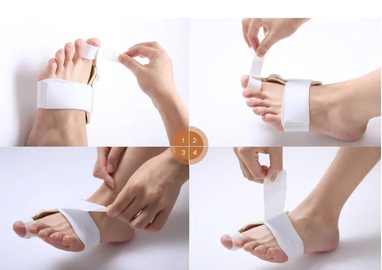 Hallux Valgus Corrector Day And Night Use Toe Talipes Valgus Brace Blackmailed Orthotics Toe Separator Single
Hallux Valgus Corrector Day And Night Use Toe Talipes Valgus Brace Blackmailed Orthotics Toe Separator Single