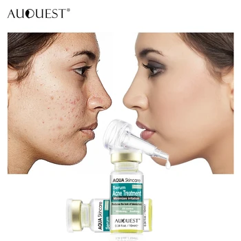 AUQUEST 2pcs Acne Treatment Face Serum Shrinks Pore Peel Off Removing Moisturizing Smoothing Skin Facial Essence Cream 20ml
AUQUEST 2pcs Acne Treatment Face Serum Shrinks Pore Peel Off Removing Moisturizing Smoothing Skin Facial Essence Cream 20ml