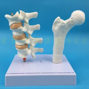Human osteoporosis health and disease comparison model skeleton femur face medical display model
Human osteoporosis health and disease comparison model skeleton femur face medical display model