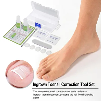 Toenail Correction Tool Set Ingrown Toe Nail Treatment Toenail Straightening Patch Nail Pusher Recover Tool Foot Care Kit
Toenail Correction Tool Set Ingrown Toe Nail Treatment Toenail Straightening Patch Nail Pusher Recover Tool Foot Care Kit