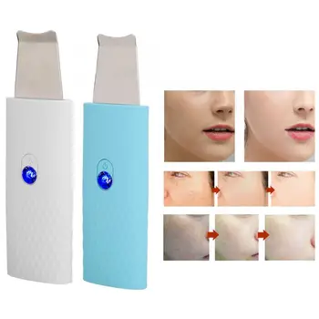 Hair Removal Machine Face Skin Scrubber Ultrasonic Cleanser Exfoliating Remove Blackheads Pore Cleanser Tool Jade
Hair Removal Machine Face Skin Scrubber Ultrasonic Cleanser Exfoliating Remove Blackheads Pore Cleanser Tool Jade
