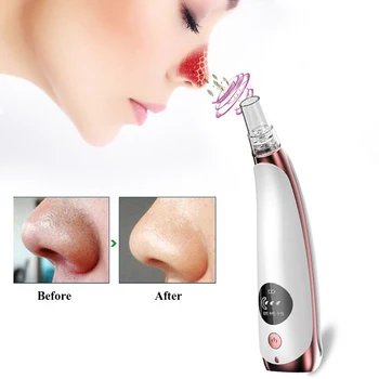 Electric Facial Vacuum Pore Cleaner Acne Blackhead Removal Extractor Machine USB Rechargeable Spot Cleaner Beauty Skin Care Tool
Electric Facial Vacuum Pore Cleaner Acne Blackhead Removal Extractor Machine USB Rechargeable Spot Cleaner Beauty Skin Care Tool
