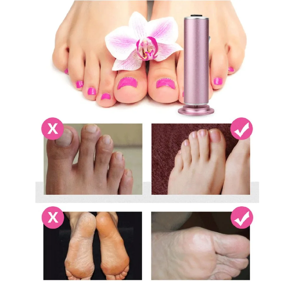Multifunctional Electric Foot Grinder Foot Grinding Machine Exfoliating Dead Skin Callus Remover Foot Care Pedicure Device New
Multifunctional Electric Foot Grinder Foot Grinding Machine Exfoliating Dead Skin Callus Remover Foot Care Pedicure Device New