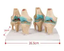 Human knee degeneration / lesion demonstration model Skeletal model Functional human joint model
Human knee degeneration / lesion demonstration model Skeletal model Functional human joint model