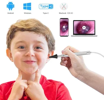Otoscope Digital 4.3mm Visual Ear Scope Camera Otoscope Cleaner Portable USB Ent Endoscope with Screen for Android Telephone PC
Otoscope Digital 4.3mm Visual Ear Scope Camera Otoscope Cleaner Portable USB Ent Endoscope with Screen for Android Telephone PC
