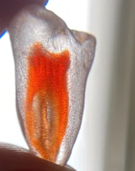 3D Simulation Tooth Replicas Lower Molar C# Model Red Pulp Root Canal Bending Endo Files Practise Dentist Student 2 Pieces
3D Simulation Tooth Replicas Lower Molar C# Model Red Pulp Root Canal Bending Endo Files Practise Dentist Student 2 Pieces