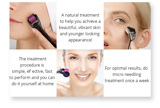 DARSONVAL 540 derma roller pure microneedling 0.2/0.25/0.3mm needles Length titanium dermoroller microniddle roller for face DARSONVAL 540 derma roller pure microneedling 0.2/0.25/0.3mm needles Length titanium dermoroller microniddle roller for face